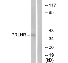 Western Blot - Anti-PRLHR Antibody (G728) - Antibodies.com