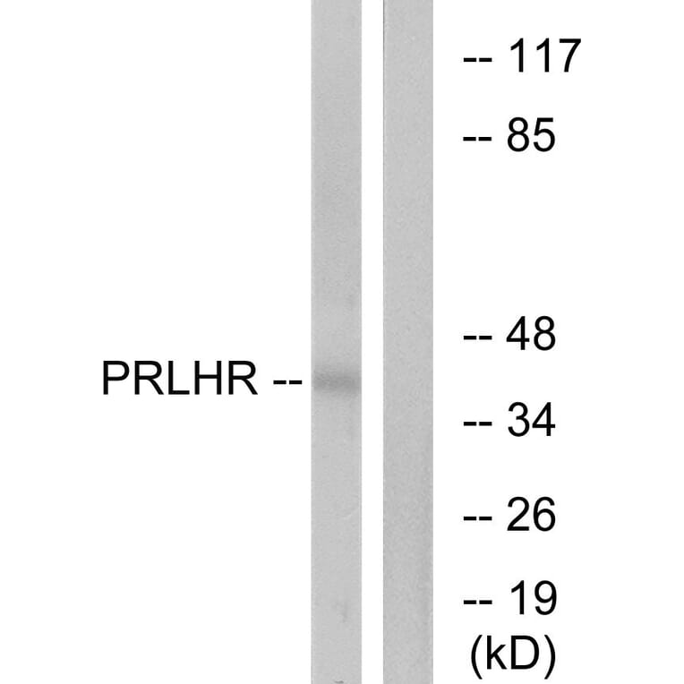 Western Blot - Anti-PRLHR Antibody (G728) - Antibodies.com