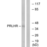 Western Blot - Anti-PRLHR Antibody (G728) - Antibodies.com