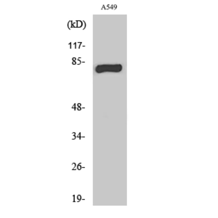 Western Blot - Anti-PRKCG Antibody (C21179) - Antibodies.com
