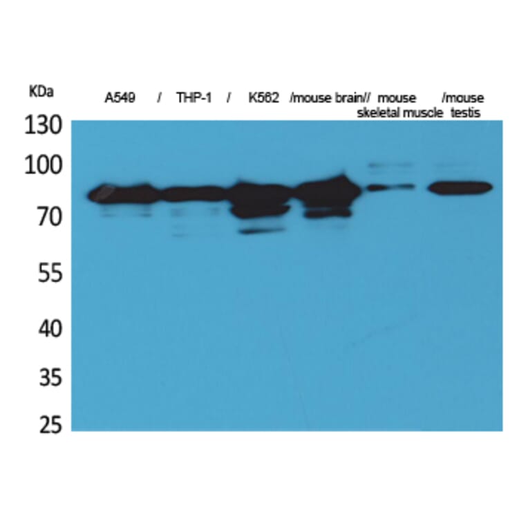 Western Blot - Anti-PRKCG Antibody (C30021) - Antibodies.com
