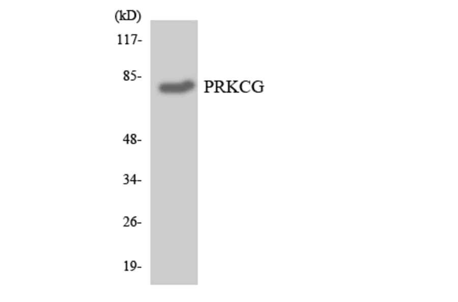 Western Blot - Anti-PRKCG Antibody (R12-3366) - Antibodies.com