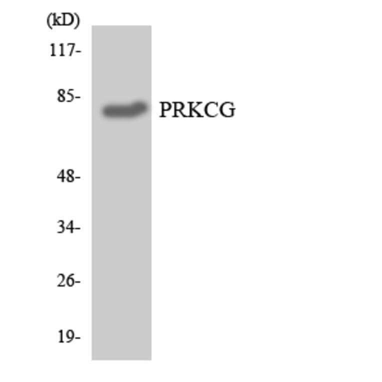 Western Blot - Anti-PRKCG Antibody (R12-3366) - Antibodies.com