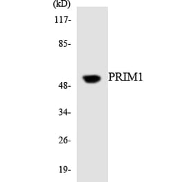 Western Blot - Anti-PRIM1 Antibody (R12-3361) - Antibodies.com