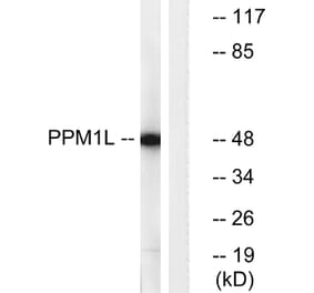 Western Blot - Anti-PPM1L Antibody (C18028) - Antibodies.com