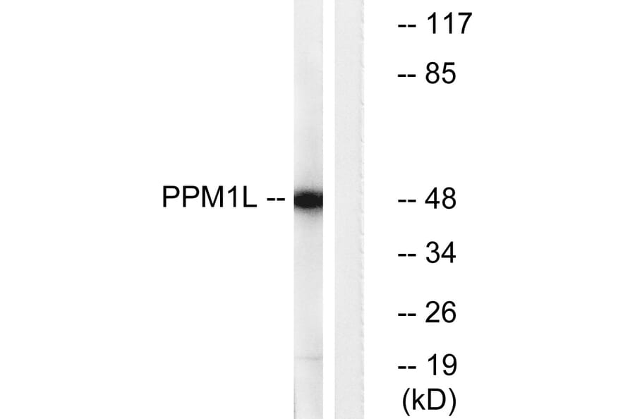 Western Blot - Anti-PPM1L Antibody (C18028) - Antibodies.com