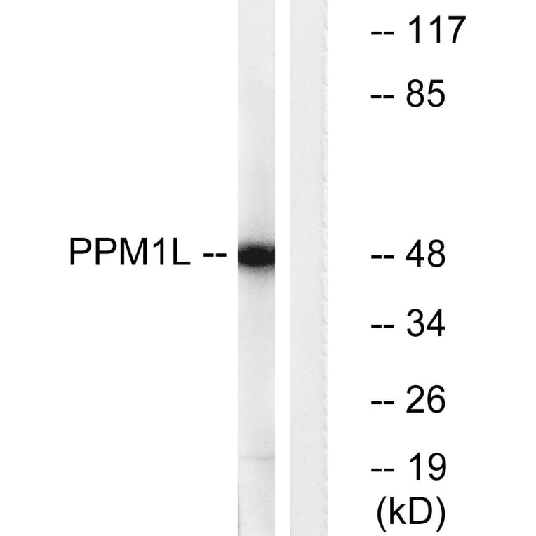 Western Blot - Anti-PPM1L Antibody (C18028) - Antibodies.com
