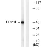 Western Blot - Anti-PPM1L Antibody (C18028) - Antibodies.com