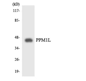 Western Blot - Anti-PPM1L Antibody (R12-3347) - Antibodies.com