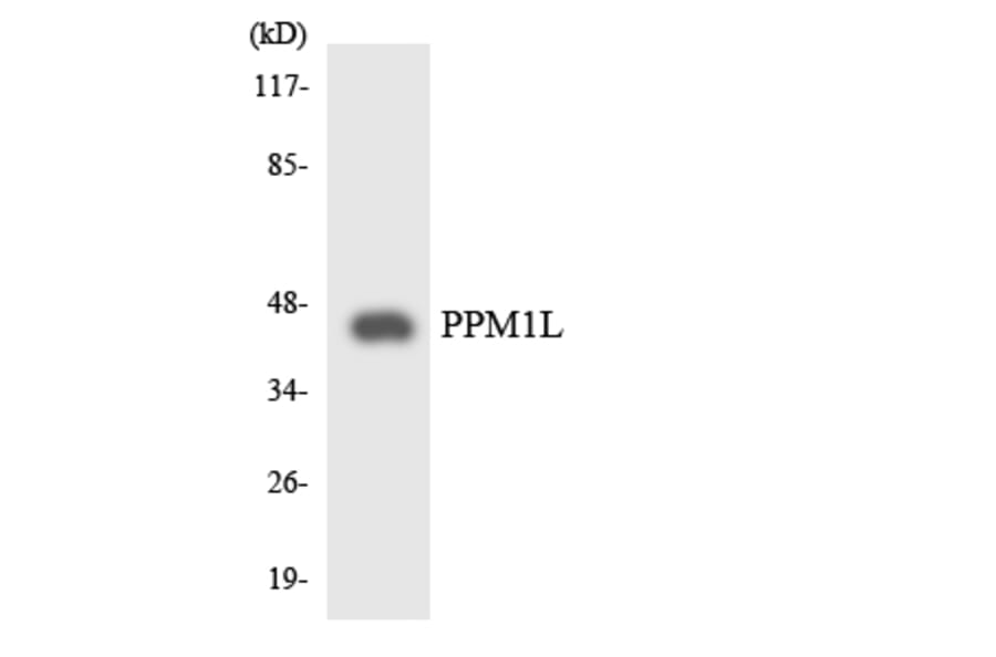 Western Blot - Anti-PPM1L Antibody (R12-3347) - Antibodies.com