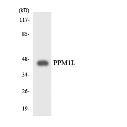 Western Blot - Anti-PPM1L Antibody (R12-3347) - Antibodies.com