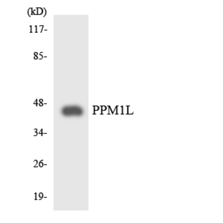 Western Blot - Anti-PPM1L Antibody (R12-3347) - Antibodies.com