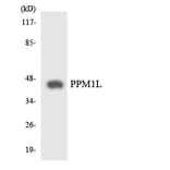 Western Blot - Anti-PPM1L Antibody (R12-3347) - Antibodies.com