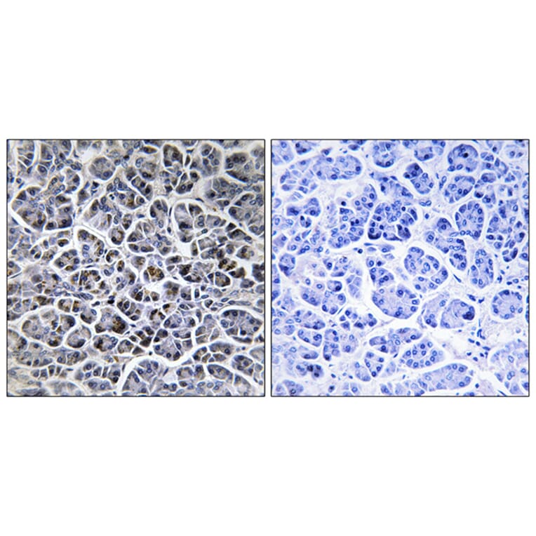 Immunohistochemistry - Anti-PPM1K Antibody (C18027) - Antibodies.com