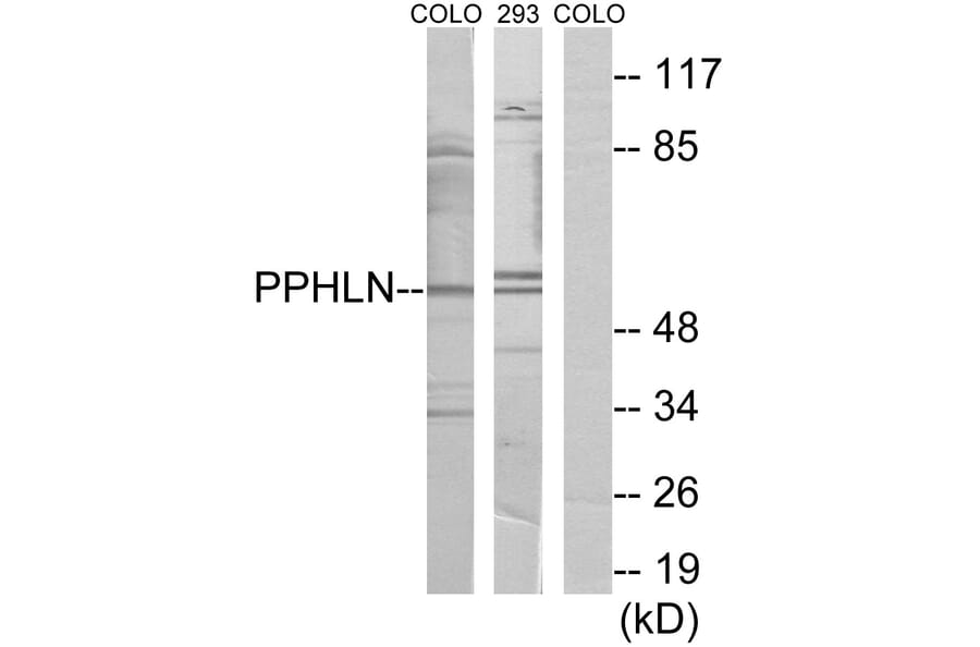 Western Blot - Anti-PPHLN Antibody (C11370) - Antibodies.com