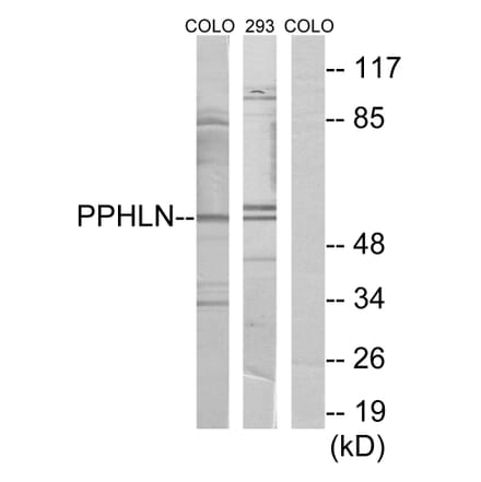 Western Blot - Anti-PPHLN Antibody (C11370) - Antibodies.com