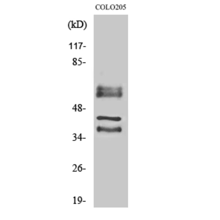 Western Blot - Anti-PPHLN Antibody (C11370) - Antibodies.com