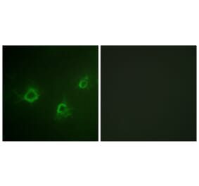 Immunofluorescence - Anti-PLCG1 Antibody (B0551) - Antibodies.com