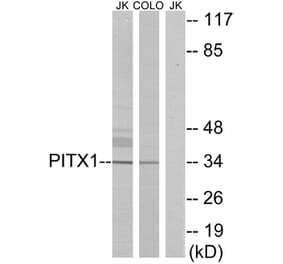 Western Blot - Anti-PITX1 Antibody (C10791) - Antibodies.com