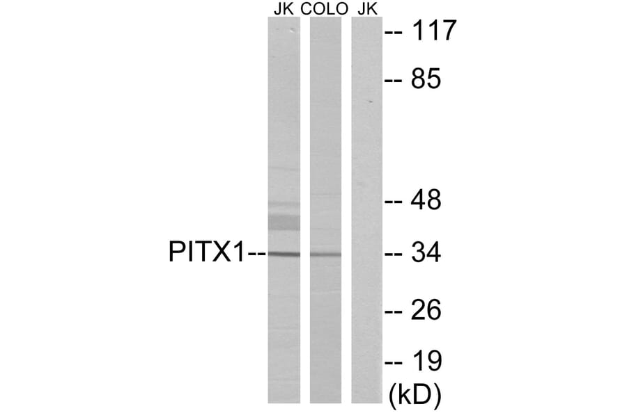 Western Blot - Anti-PITX1 Antibody (C10791) - Antibodies.com