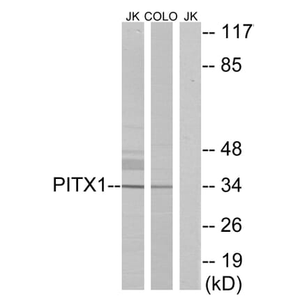 Western Blot - Anti-PITX1 Antibody (C10791) - Antibodies.com