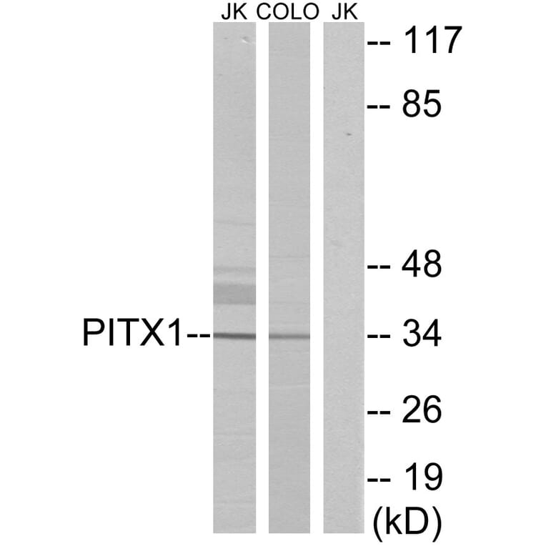 Western Blot - Anti-PITX1 Antibody (C10791) - Antibodies.com