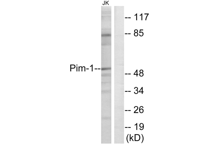 Western Blot - Anti-Pim-1 Antibody (B0712) - Antibodies.com