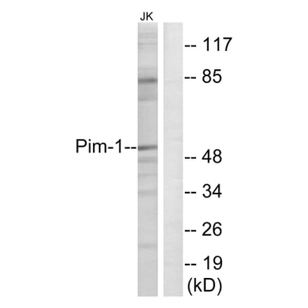 Western Blot - Anti-Pim-1 Antibody (B0712) - Antibodies.com