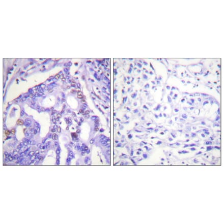 Immunohistochemistry - Anti-PIAS4 Antibody (C0364) - Antibodies.com