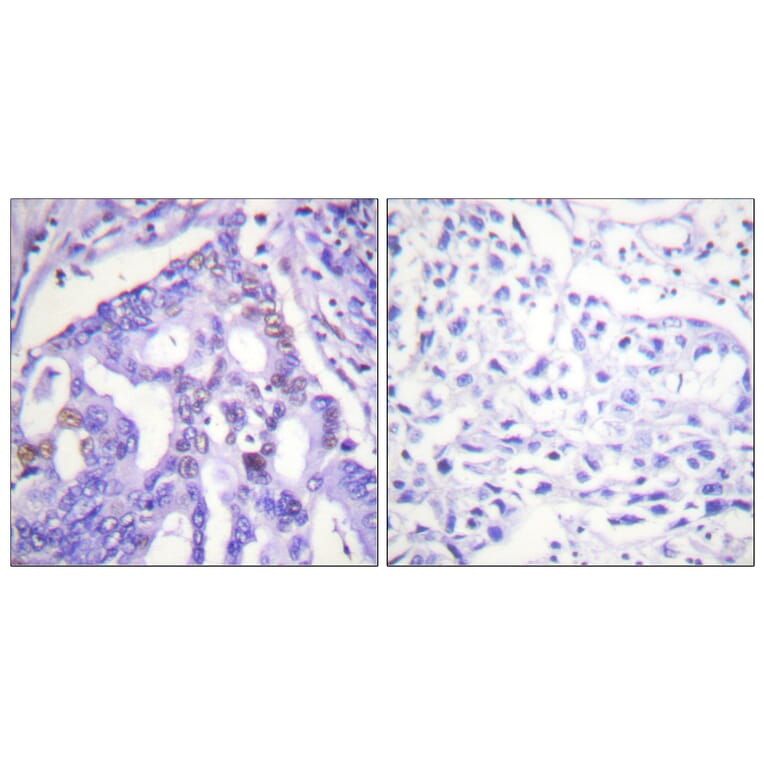 Immunohistochemistry - Anti-PIAS4 Antibody (C0364) - Antibodies.com