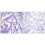 Immunohistochemistry - Anti-PIAS4 Antibody (C0364) - Antibodies.com