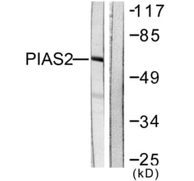 Western Blot - Anti-PIAS2 Antibody (C0362) - Antibodies.com