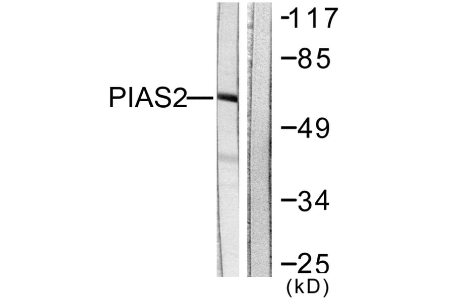 Western Blot - Anti-PIAS2 Antibody (C0362) - Antibodies.com