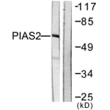Western Blot - Anti-PIAS2 Antibody (C0362) - Antibodies.com