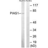 Western Blot - Anti-PIAS1 Antibody (C0361) - Antibodies.com