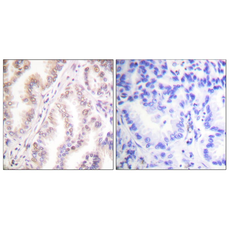 Immunohistochemistry - Anti-PIAS1 Antibody (C0361) - Antibodies.com