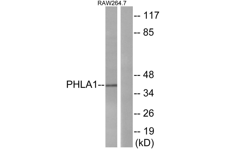 Western Blot - Anti-PHLA1 Antibody (C13101) - Antibodies.com