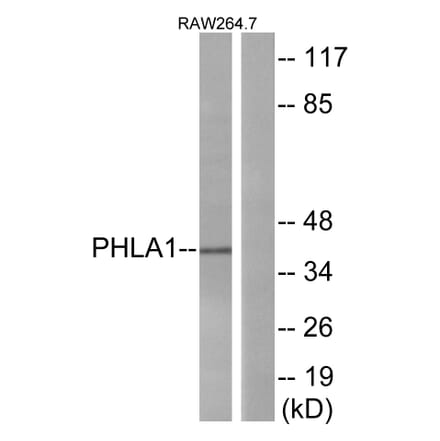 Western Blot - Anti-PHLA1 Antibody (C13101) - Antibodies.com