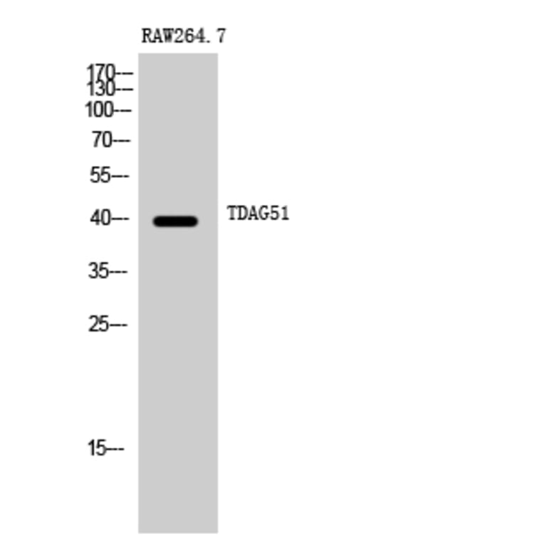 Western Blot - Anti-PHLA1 Antibody (C13101) - Antibodies.com