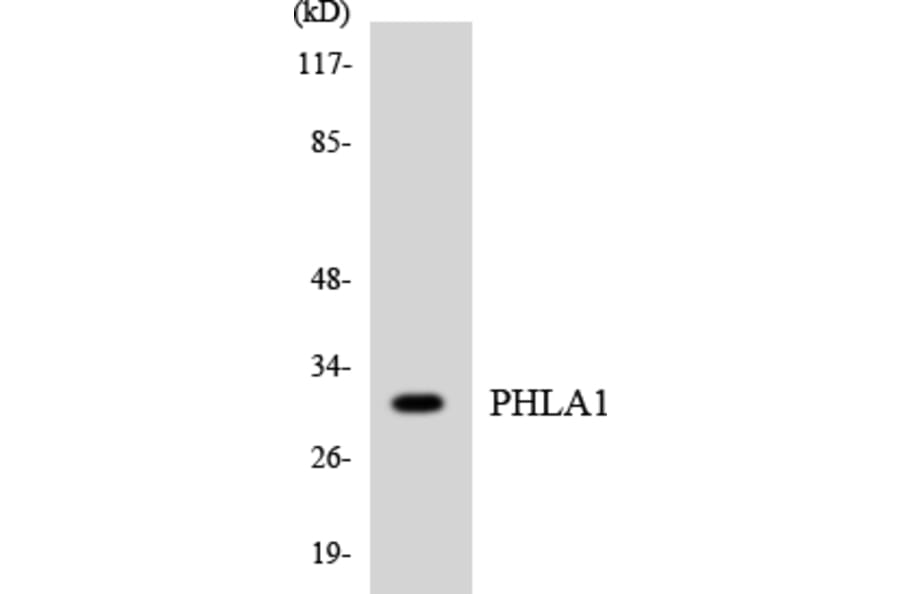 Western Blot - Anti-PHLA1 Antibody (R12-3325) - Antibodies.com