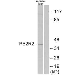Western Blot - Anti-PE2R2 Antibody (G097) - Antibodies.com