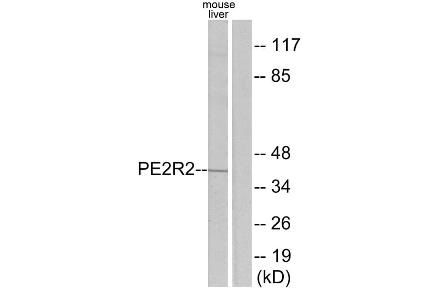 Western Blot - Anti-PE2R2 Antibody (G097) - Antibodies.com