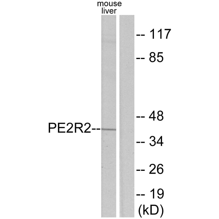 Western Blot - Anti-PE2R2 Antibody (G097) - Antibodies.com