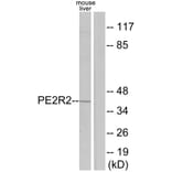 Western Blot - Anti-PE2R2 Antibody (G097) - Antibodies.com