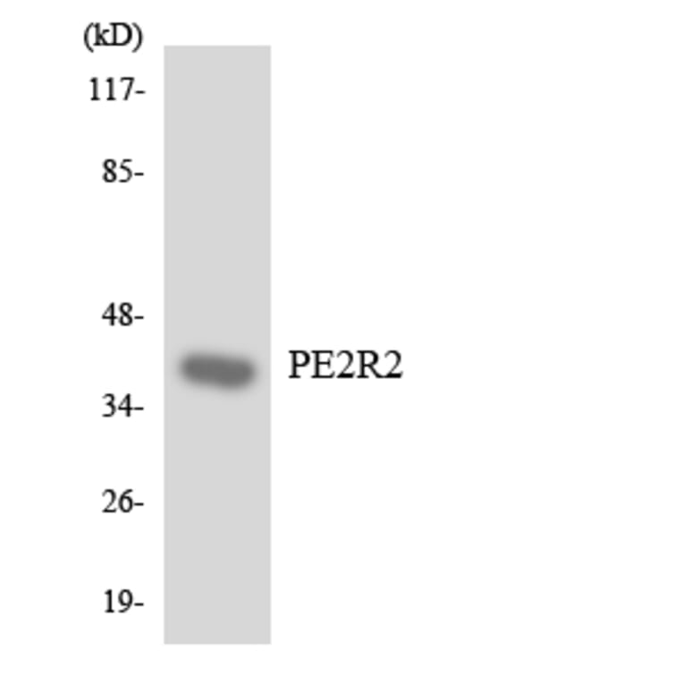 Western Blot - Anti-PE2R2 Antibody (R12-3311) - Antibodies.com
