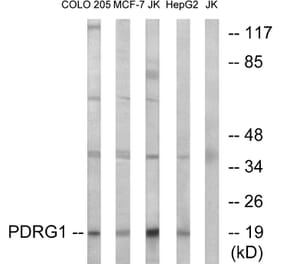 Western Blot - Anti-PDRG1 Antibody (C17587) - Antibodies.com