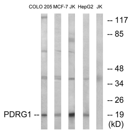 Western Blot - Anti-PDRG1 Antibody (C17587) - Antibodies.com