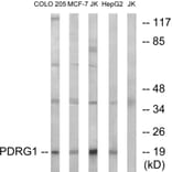 Western Blot - Anti-PDRG1 Antibody (C17587) - Antibodies.com