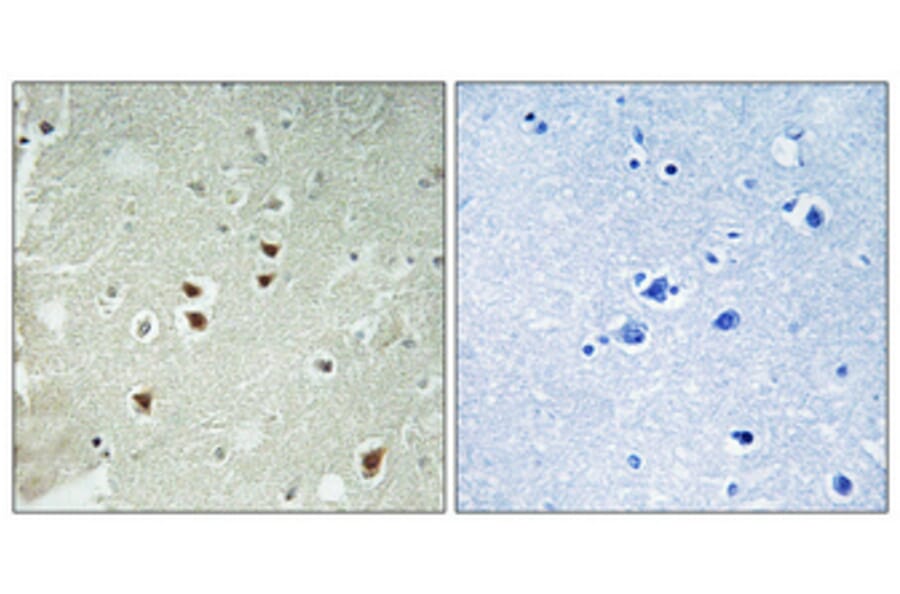 Immunohistochemistry - Anti-PDRG1 Antibody (C17587) - Antibodies.com