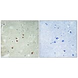 Immunohistochemistry - Anti-PDRG1 Antibody (C17587) - Antibodies.com